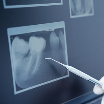 Dentist showing an X-ray to a patient 