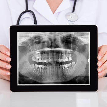 Dental x-rays on tablet computer